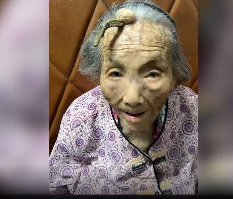 Centenarian Lola, Tinubuan ng sungay kaya humaba ang&nbsp;buhay?